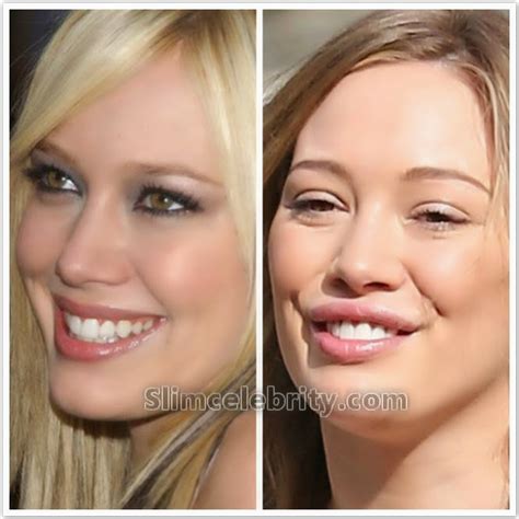 hillary duff nose job|Viral Hilary Duff Photo Has People Questioning If It’s Real